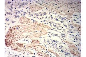 Immunohistochemistry (IHC) image for anti-Myosin Light Chain Kinase (MYLK) (AA 1375-1524) antibody (ABIN7193606)