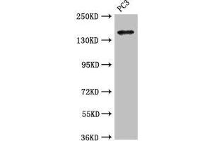 Western Blot Positive WB detected in: PC-3 whole cell lysate All lanes: ASTN2 antibody at 3. (Astrotactin 2 抗体  (AA 108-272))