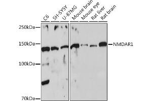 Western blot analysis of extracts of various cell lines, using NMD Rabbit pAb (ABIN6133733, ABIN6141400, ABIN6141403 and ABIN6223602) at 1:500 dilution. (GRIN1/NMDAR1 抗体  (AA 600-700))