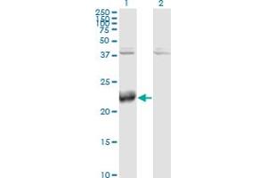 Western Blot analysis of ATF3 expression in transfected 293T cell line by ATF3 monoclonal antibody (M04), clone 8G5. (ATF3 抗体  (AA 1-181))