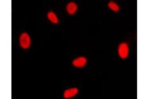 Immunofluorescent analysis of RXR gamma staining in NIH3T3 cells. (Retinoid X Receptor gamma 抗体  (Center))