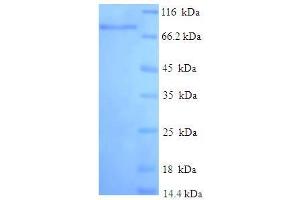 SDS-PAGE (SDS) image for Interferon-Induced Protein with Tetratricopeptide Repeats 3 (IFIT3) (AA 1-490), (full length) protein (His-SUMO Tag) (ABIN5709709)