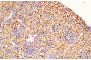 Immunohistochemistry of paraffin-embedded Rat spleen using CD44 Polycloanl Antibody at dilution of 1:200 (CD44 抗体)