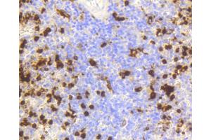 Immunohistochemistry of paraffin-embedded human spleen using LYZ antibody. (LYZ 抗体)