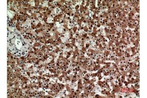 Immunohistochemistry (IHC) analysis of paraffin-embedded Human Liver, antibody was diluted at 1:100.