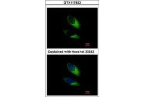 Image no. 3 for anti-Synaptosomal-Associated Protein, 23kDa (SNAP23) (AA 6-211) antibody (ABIN1501021) (SNAP23 抗体  (AA 6-211))
