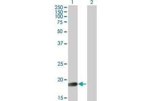 Western Blot analysis of GLYAT expression in transfected 293T cell line by GLYAT MaxPab polyclonal antibody. (GLYAT 抗体  (AA 1-163))