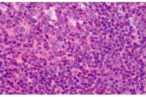 Human Tonsil: Formalin-Fixed, Paraffin-Embedded (FFPE) (TK1 抗体  (N-Term))