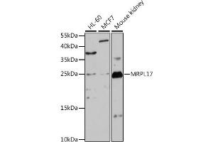 Western blot analysis of extracts of various cell lines, using MRPL17 antibody (ABIN7268559) at 1:1000 dilution. (MRPL17 抗体  (AA 86-175))