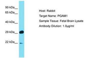 Image no. 1 for anti-phosphoglycerate Mutase 1 (Brain) (PGAM1) (C-Term) antibody (ABIN6750470) (PGAM1 抗体  (C-Term))