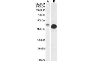 ABIN570972 (0. (Connexin 43/GJA1 抗体  (Internal Region))