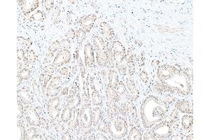 Immunohistochemistry (IHC) image for anti-Denticleless E3 Ubiquitin Protein Ligase Homolog (DTL) (C-Term) antibody (ABIN7454696) (CDT2/RAMP 抗体  (C-Term))