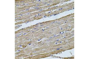 Immunohistochemistry of paraffin-embedded rat heart using FLNB antibody. (FLNB 抗体)