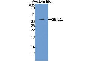 Western blot analysis of the recombinant protein. (Tyrosine Hydroxylase 抗体  (AA 34-301))
