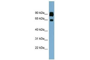 CLPTM1L antibody used at 1 ug/ml to detect target protein. (CLPTM1L 抗体  (Middle Region))