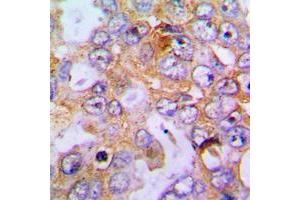 Immunohistochemistry (IHC) image for anti-Collagen, Type XVIII, alpha 1 (COL18A1) (C-Term) antibody (ABIN7298410)