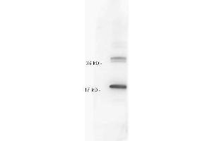 Anti IL-10 whole antiserum  was tested against recombinant IL10. (IL-10 抗体)