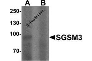 Western Blotting (WB) image for anti-Small G Protein Signaling Modulator 3 (SGSM3) (N-Term) antibody (ABIN1077375) (SGSM3 抗体  (N-Term))