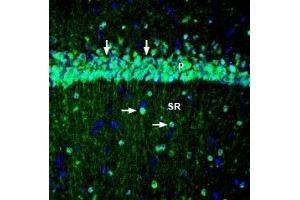 Immunohistochemistry (IHC) image for anti-Potassium Voltage-Gated Channel, KQT-Like Subfamily, Member 3 (KCNQ3) (AA 668-686), (Intracellular) antibody (ABIN7043505)