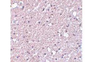 Immunohistochemistry staining of human brain tissue (Paraffin section) with TMEM184A Antibody   at 5 μg/ml. (TMEM184A 抗体  (C-Term))