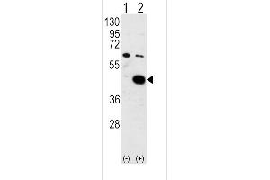 Western blot analysis of PDK2 (arrow) using PDK2 Antibody (C-term) (ABIN391037 and ABIN2841203). (PDK2 抗体  (C-Term))