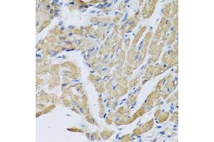 Immunohistochemistry of paraffin-embedded mouse heart using CRHBP antibody at dilution of 1:100 (40x lens). (CRHBP 抗体)