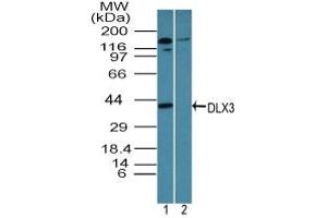 Image no. 1 for anti-Distal-Less Homeobox 3 (DLX3) (AA 220-270) antibody (ABIN960137) (DLX3 抗体  (AA 220-270))