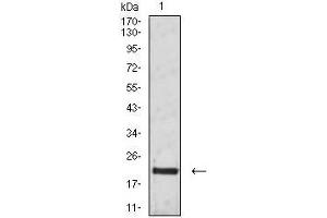 Western blot analysis using CD3G mouse mAb against Jurkat (1) cell lysate. (CD3G 抗体  (AA 23-116))
