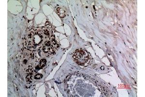Immunohistochemistry (IHC) analysis of paraffin-embedded Human Breast, antibody was diluted at 1:100. (NF-kB p65 抗体  (acLys314, acLys315))