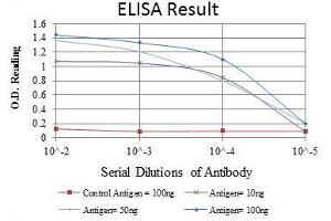 Red: Control Antigen (100 ng), Purple: Antigen (10 ng), Green: Antigen (50 ng), Blue: Antigen (100 ng), (CEA 抗体)