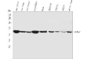 Western blot analysis of ACAA2 using anti-ACAA2 antibody (ABIN4886414).