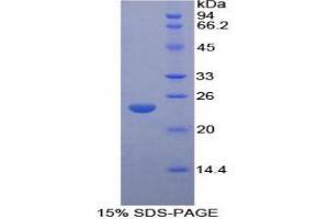 SDS-PAGE (SDS) image for Proteasome (Prosome, Macropain) Subunit, beta Type, 8 (Large Multifunctional Peptidase 7) (PSMB8) protein (ABIN3010426)
