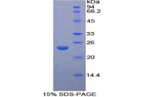 SDS-PAGE analysis of Rat LMP7 Protein. (PSMB8 蛋白)
