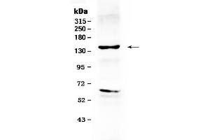 Western blot analysis of ErbB 2 using anti- ErbB 2 antibody . (ErbB2/Her2 抗体  (N-Term))