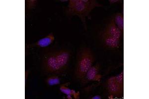 Immunofluorescence staining of methanol-fixed HeLa cells using JunB (Phospho-Ser79) Antibody (E011026, Red) (JunB 抗体  (pSer79))