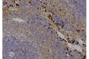 ABIN6279104 at 1/100 staining Human lymph node tissue by IHC-P. (AKR1C4 抗体)