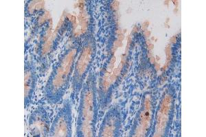 Used in DAB staining on fromalin fixed paraffin- embedded intestine tissue (KRT20 抗体  (AA 75-382))