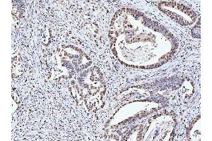 IHC analysis of MCM6 using anti-MCM6 antibody (ABIN7600038). (MCM6 抗体  (AA 14-821))