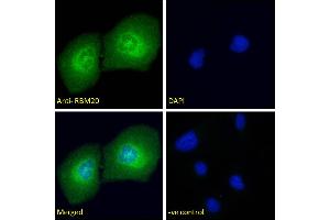 ABIN571262 Immunofluorescence analysis of paraformaldehyde fixed U2OS cells, permeabilized with 0. (RBM20 抗体  (AA 717-727))