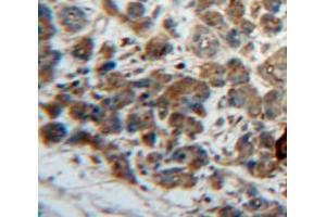 IHC-P analysis of Pancreas tissue, with DAB staining. (LEFTY1 抗体  (AA 43-364))