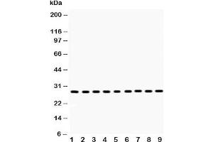 Western Blotting (WB) image for anti-Peroxiredoxin 3 (PRDX3) (AA 110-256) antibody (ABIN3032189)