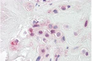 ABIN571113 (3. (PON2 抗体  (Internal Region))