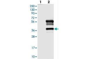 Western blot analysis of Lane 1: Negative control (vector only transfected HEK293T lysate), Lane 2: Over-expression Lysate (Co-expressed with a C-terminal myc-DDK tag (~3. (TTC19 抗体)