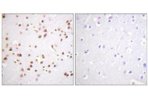 Immunohistochemistry (IHC) image for anti-Catenin (Cadherin-Associated Protein), delta 1 (CTNND1) (Tyr228) antibody (ABIN1848016) (CTNND1 抗体  (Tyr228))
