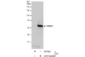 IP Image Immunoprecipitation of TRIM27 protein from Jurkat whole cell extracts using 5 μg of TRIM27 antibody, Western blot analysis was performed using TRIM27 antibody, EasyBlot anti-Rabbit IgG  was used as a secondary reagent. (TRIM27 抗体)