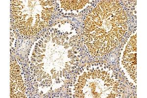 ABIN7095697 and ABIN7099759 at 1/100 staining mouse testis tissue by IHC-P.