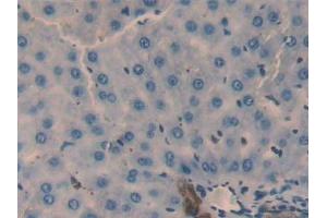 Detection of GAL2 in Rat Liver Tissue using Polyclonal Antibody to Galectin 2 (GAL2) (Gallinacin-2 (GAL2) (AA 1-130) 抗体)