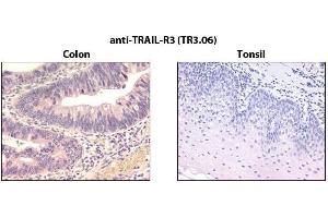 Immunohistochemistry detection of endogenous TRAIL-R3 in paraffin-embedded human carcinoma tissues (colon, tonsil) using mAb to TRAIL-R3 (TR3. (DcR1 抗体)