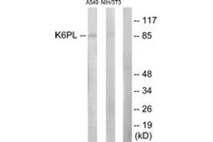 Western blot analysis of extracts from A549/NIH-3T3 cells, using K6PL Antibody. (PFKL 抗体  (AA 691-740))