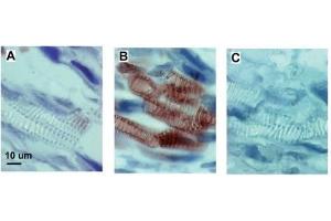 Immunohistochemistry (IHC) image for anti-Keyhole Limpet Hemocyanin (KLH) antibody (ABIN93503) (KLH 抗体)